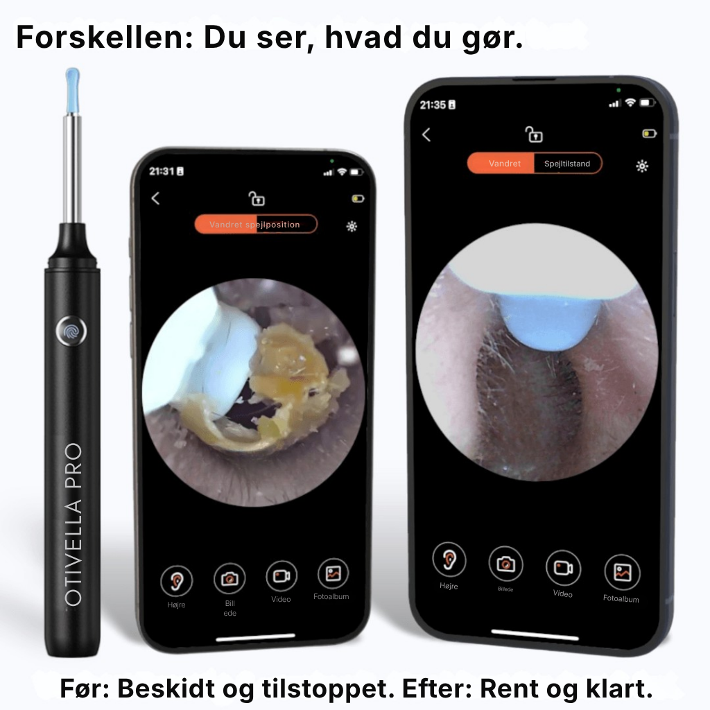 Otivella™ Pro | Den første visuelle ørerens med SmartSigt™-teknologi