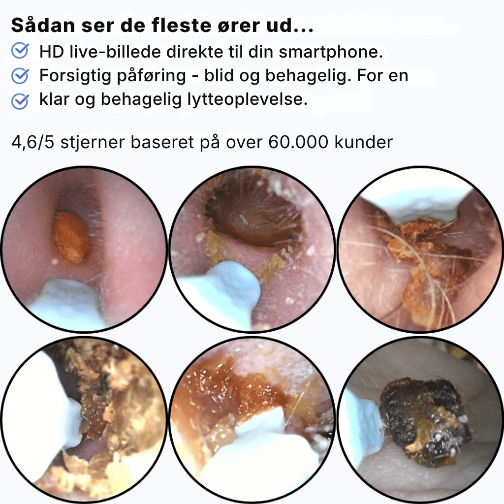 Otivella™ Pro | Den første visuelle ørerens med SmartSigt™-teknologi