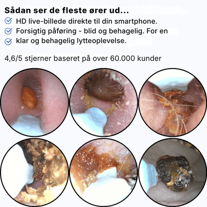 Otivella™ Pro | Den første visuelle ørerens med SmartSigt™-teknologi